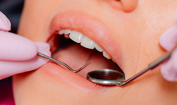igiene-dentale